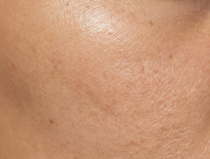 Công dụng PRO-RETINOL 0.6