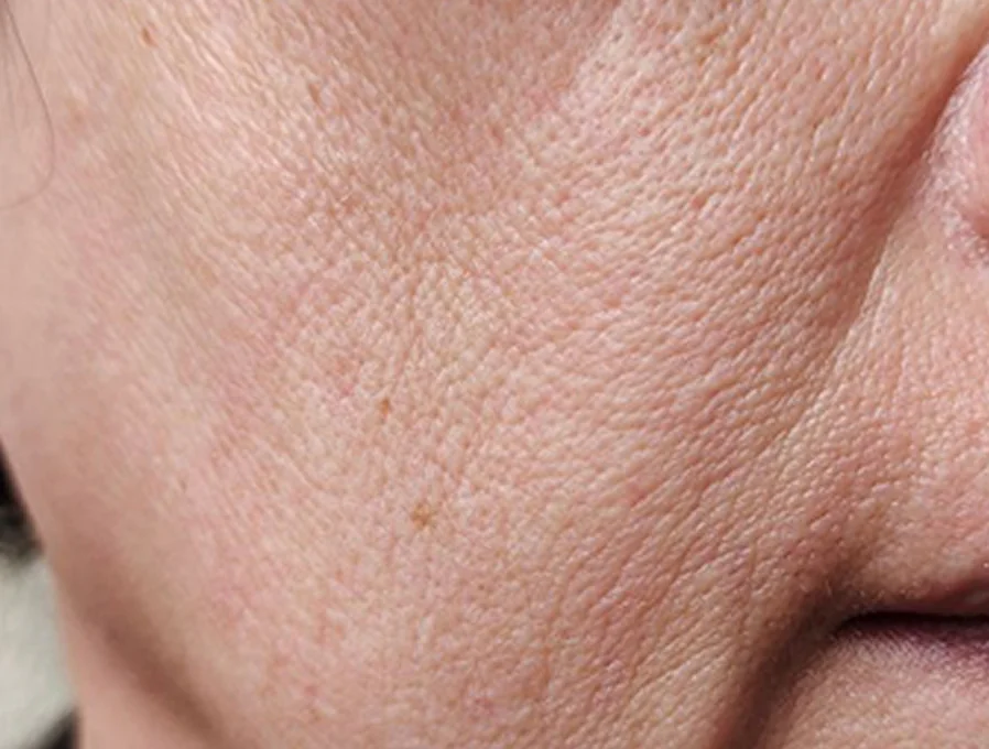 Công dụng PRO-RETINOL 0.6