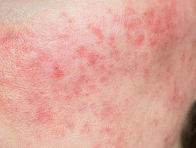 Công dụng PRO-RETINOL 0.6