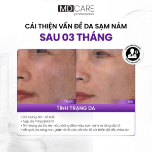 Ảnh case lâm sàng - cải thiện vấn đề da sạm nám sau 3 tháng